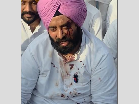 FIR against 300+ after alleged attack on Congress leaders, Warring, Zira demand strict action