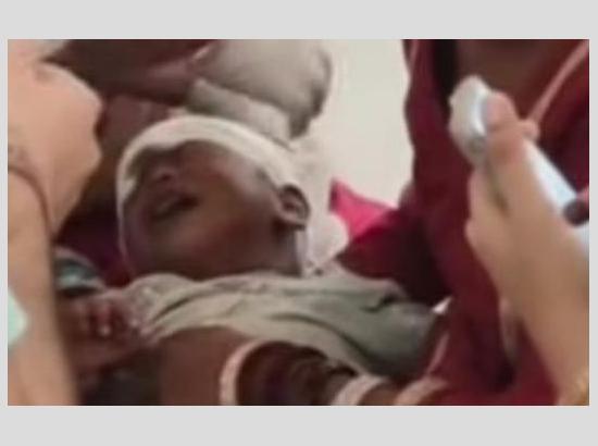 Stray Dog Menace Escalates: 1-yr-old mauled, 100 bite cases reported in 48 hours