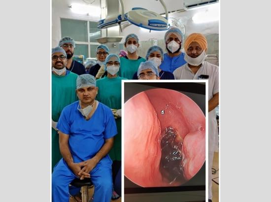 Rajindra Hospital Patiala Doctors Perform Surgery on a Post COVID Case of Mucormycosis